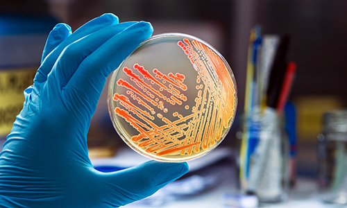 Microbiology Testing Services