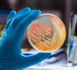 gloved hand holding petri dish growing culture. Biological Tissue Analysis (BIOTA), Biota laboratories