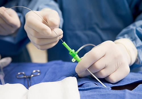 Close-up of a surgeon’s gloved hands threading a thin tube into a green connector over a blue sterile drape.