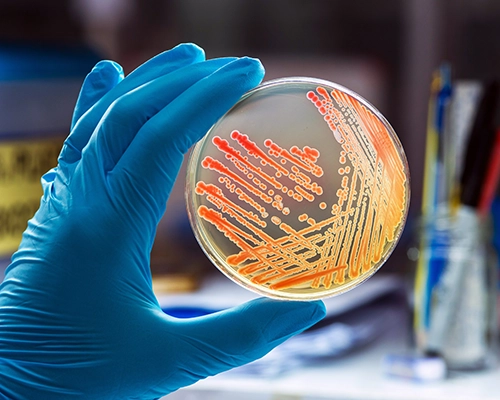 Blue nitrile-gloved hand holding a petri dish with orange bacterial colonies against a blurred lab background.